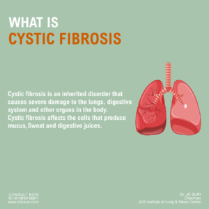 Cystic Fibrosis (CF): Symptoms, Causes, Diagnosis & Treatment