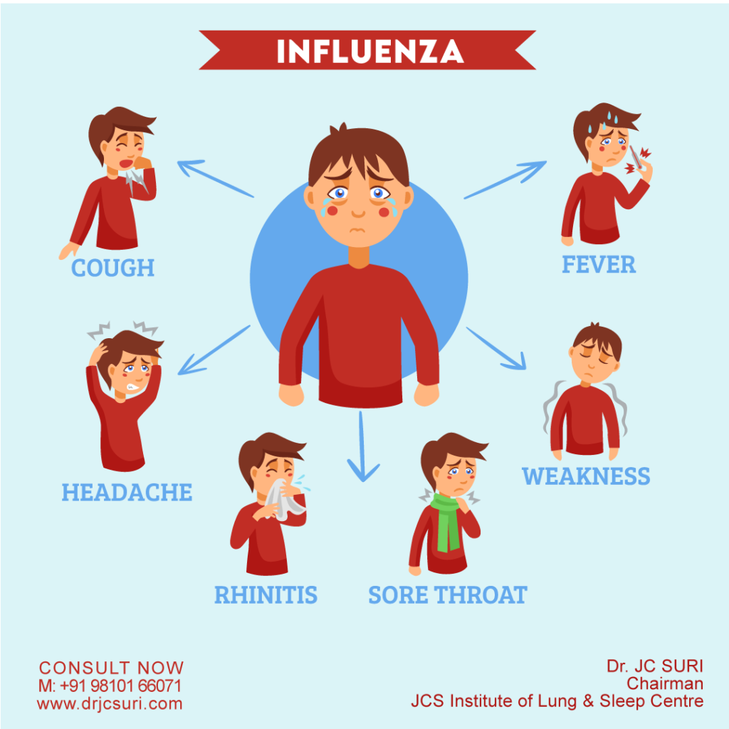 Influenza (Flu): Symptoms, Causes, Complications