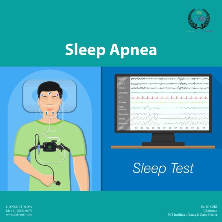 Comprehensive Sleep Study Test Insights for Better Rest