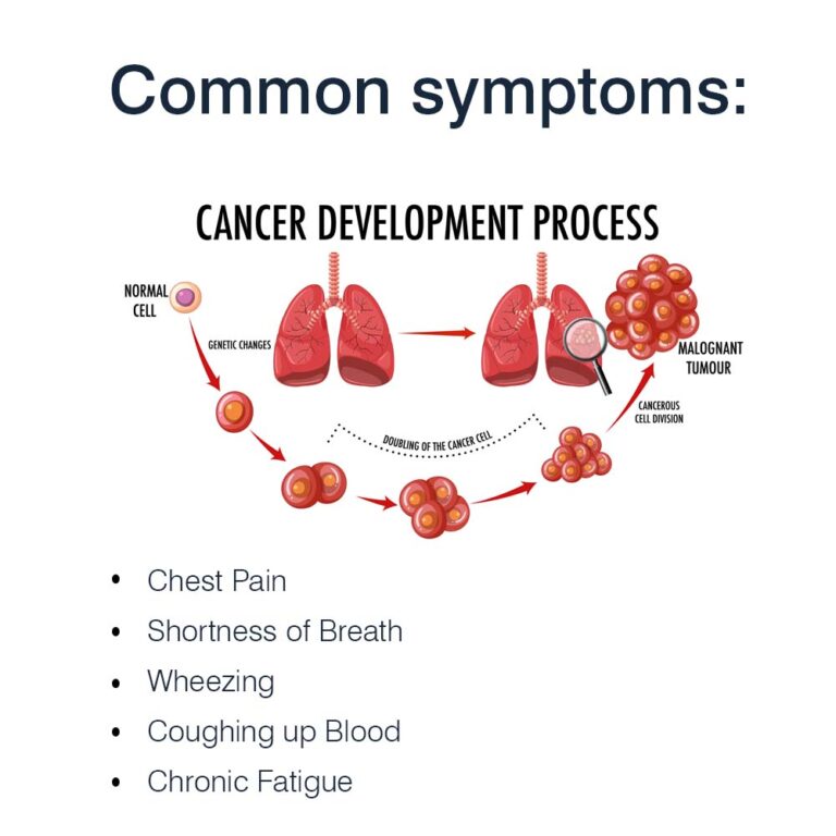 lung-cancer-symptoms-types-treatments