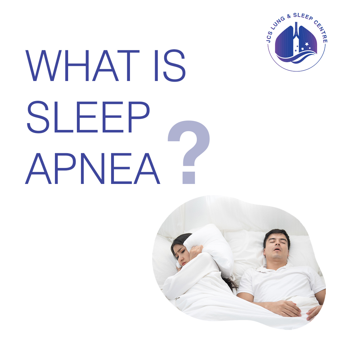 Sleep Apnea: Symptoms, Causes, and Effective Treatments